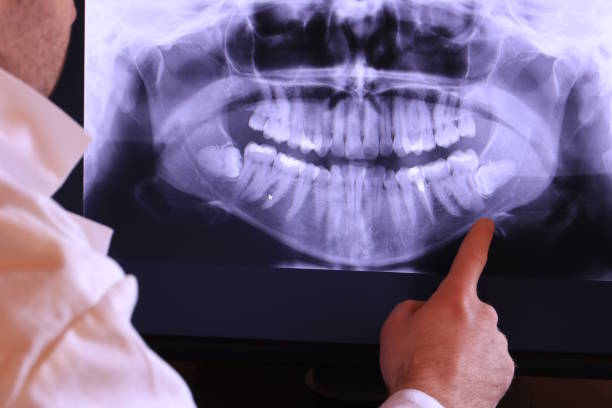 Best Emergency Gum Pain Relief  in Magnolia Springs, AL