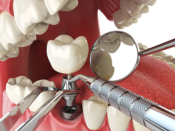 Best Dentist for Tooth Abscess  in Magnolia Springs, AL